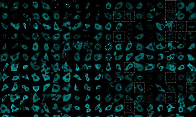 Teams find secret behind cancer cell movement in metastasis